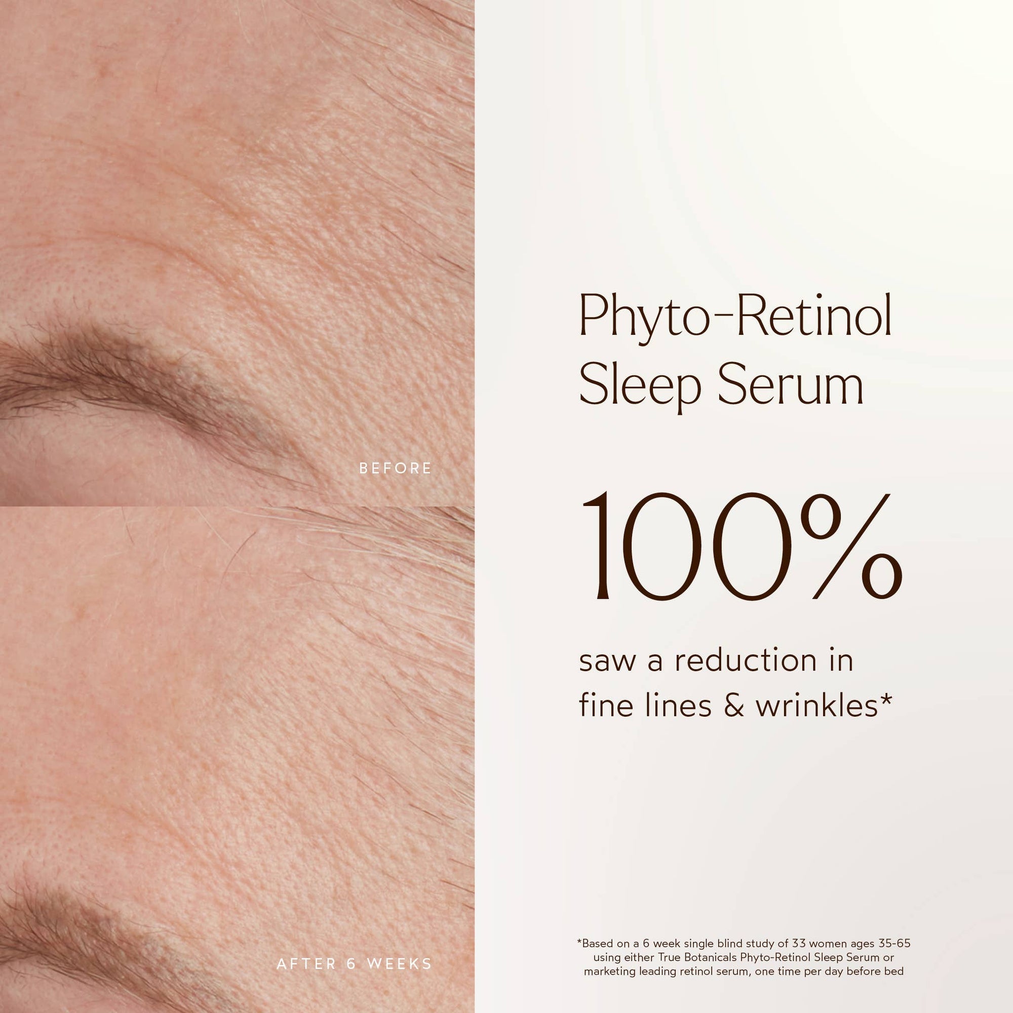 Phyto Retinol Anti-Aging Sleep Treatment by True Botanicals