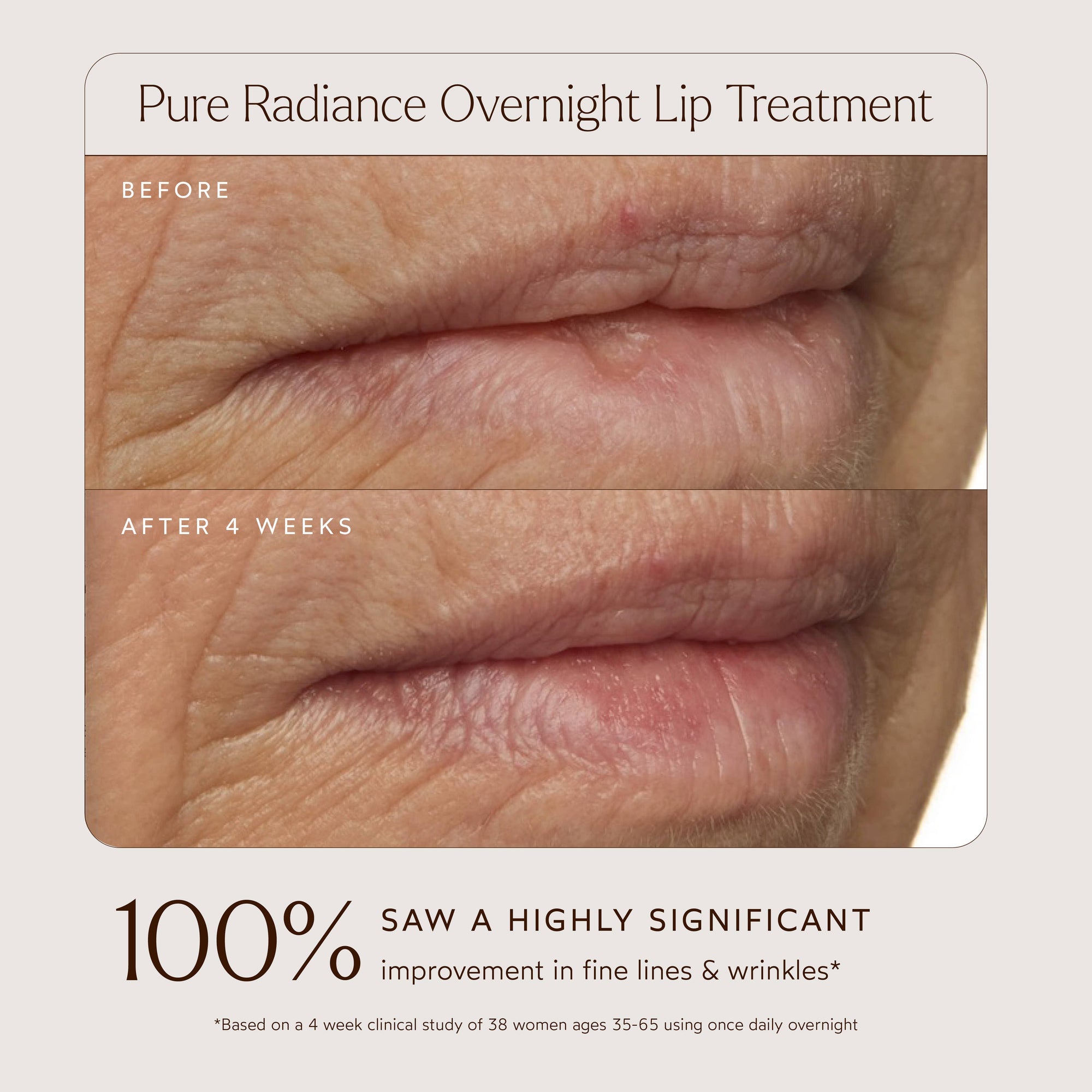 True Botanicals Overnight Repair Lip Treatment